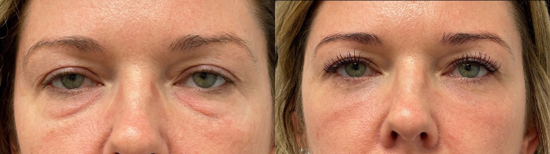 before_after_image_combined