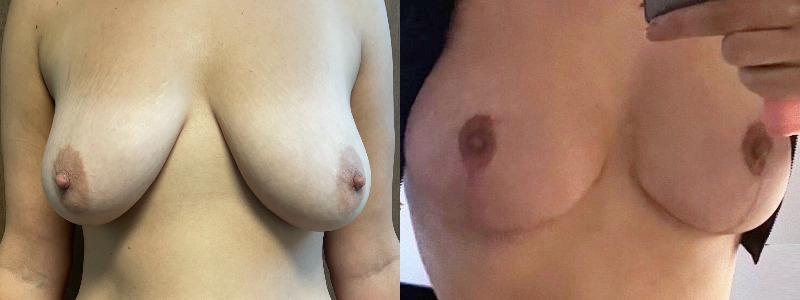 before_after_image_combined