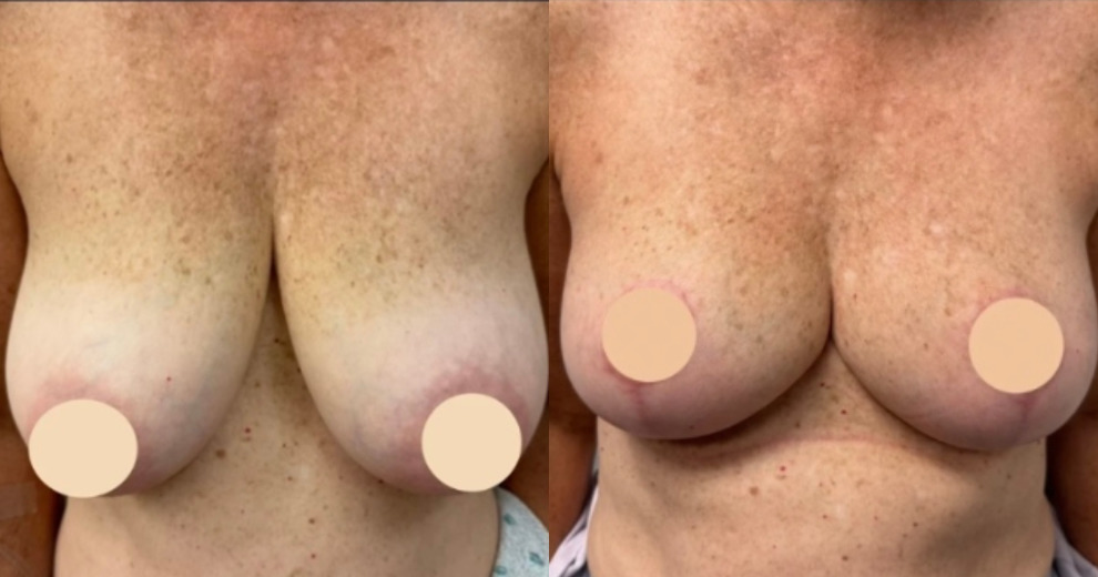 before_after_image_combined